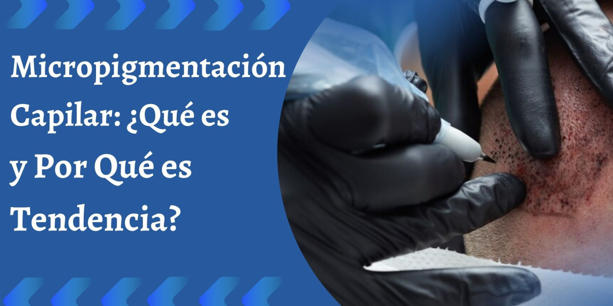 Micropigmentación Capilar: ¿Qué es y Por Qué es Tendencia?