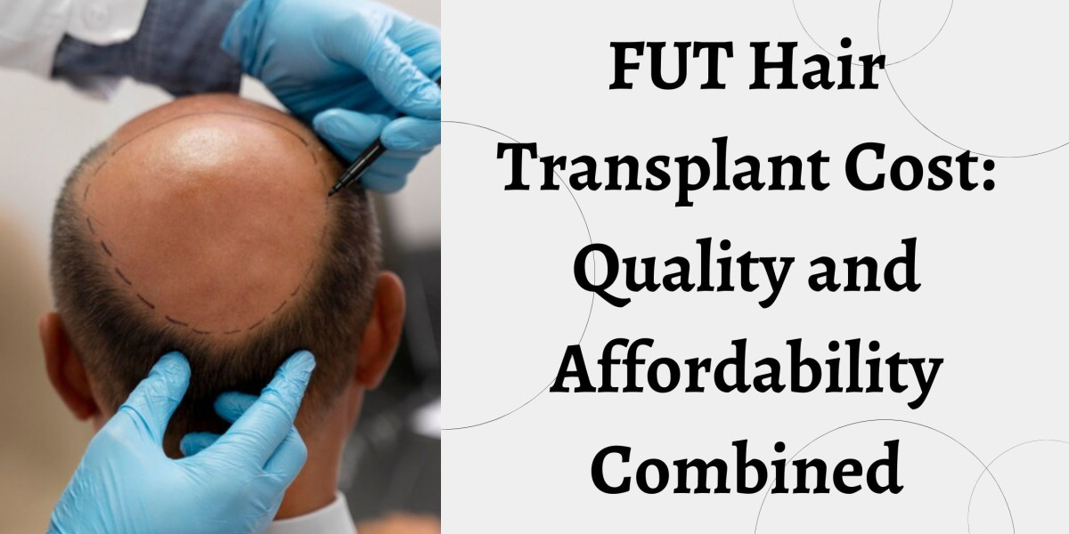 FUT Hair Transplant Cost: Quality and Affordability Combined